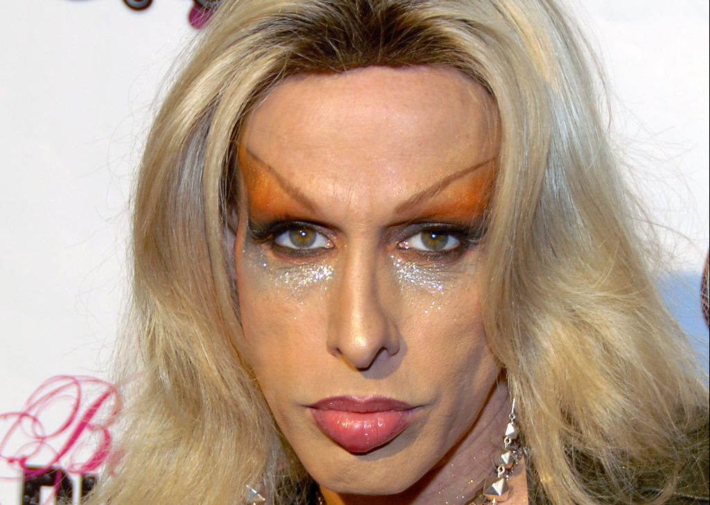 Alexis Arquette’s cause of death revealed