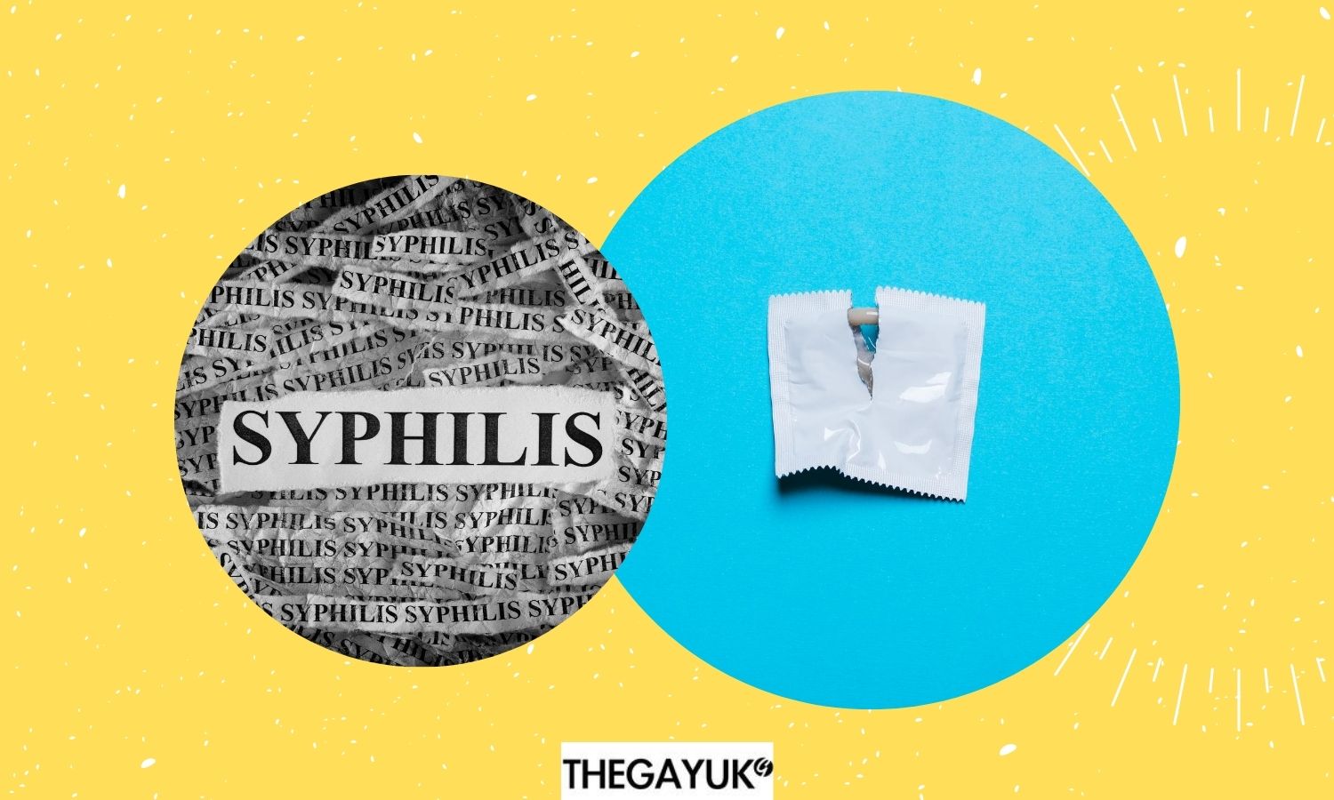 Everything you need to know about Syphilis