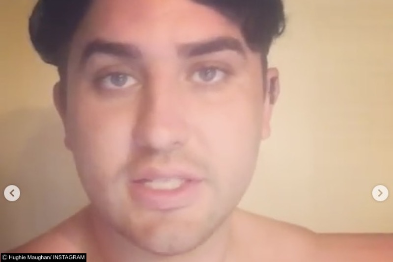 Big Brother star Hughie Maughan got a Brazilian bum lift 1