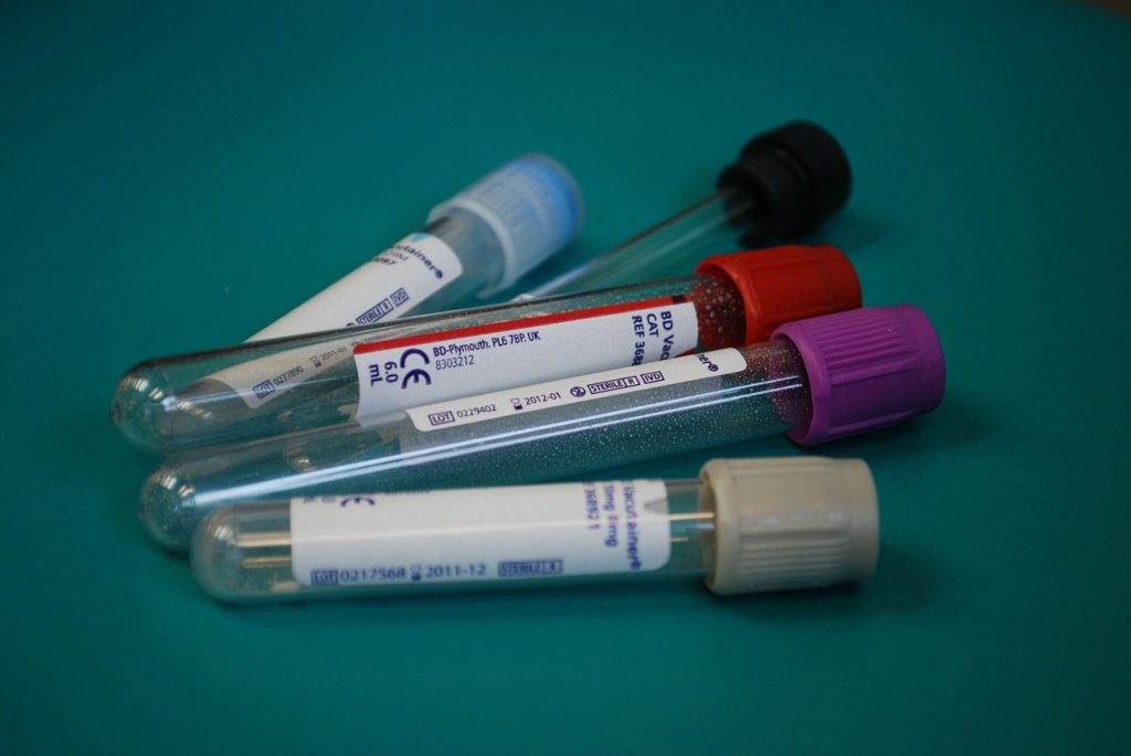 Gay Blood. 'Delays might be justified if it applied to everyone' not just gay and bi men 2